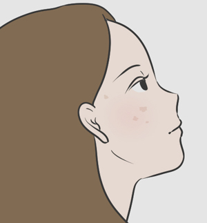健康への悪影響